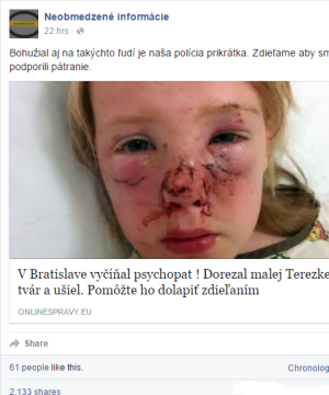 Psychopat (imigrant) napadol v Bratislave dievčatko.  Do večera 20..2. správu zdieľalo 2133 ľudí.